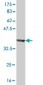 GMPPB Antibody (monoclonal) (M07)